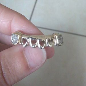 Real gold authentic grillz molded to your teeth